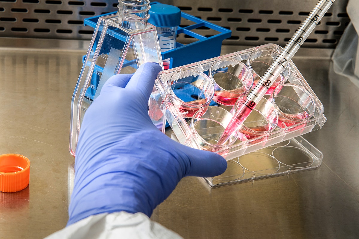 Monkeypox Found in San Francisco Water.