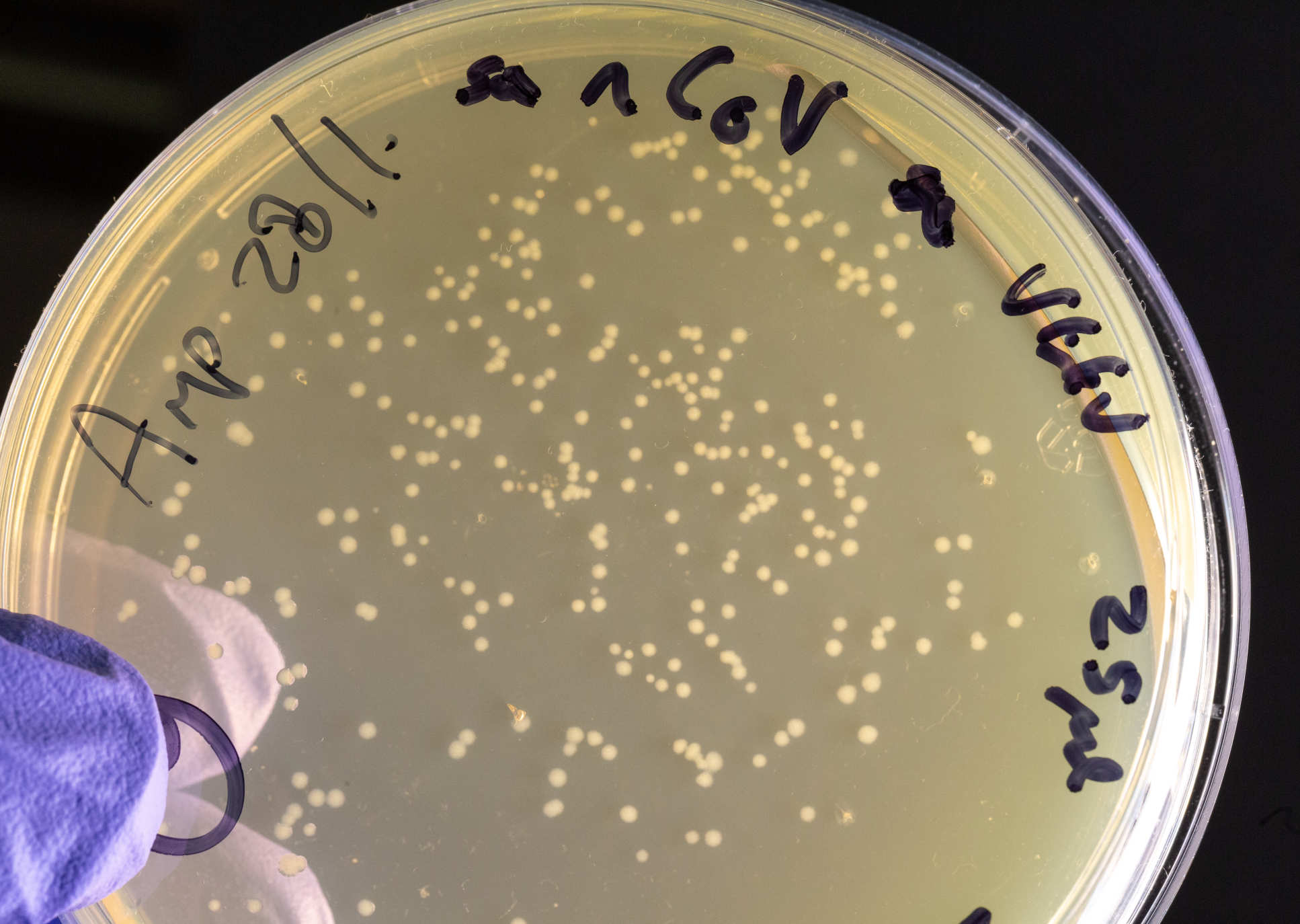 coronavirus